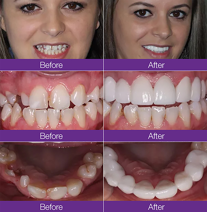 Mcomie_B&A3